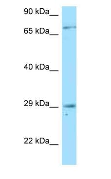 TNFRSF13B / TACI Antibody (aa43-92)