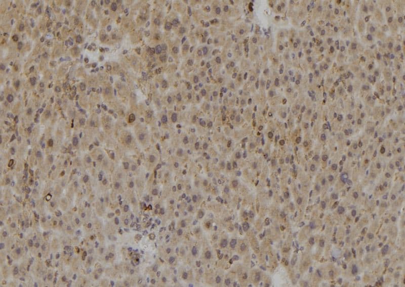 CASP8 / Caspase 8 Antibody