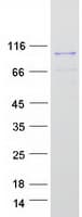 Human WDR91 Protein (Recombinant Myc-DDK (Flag))