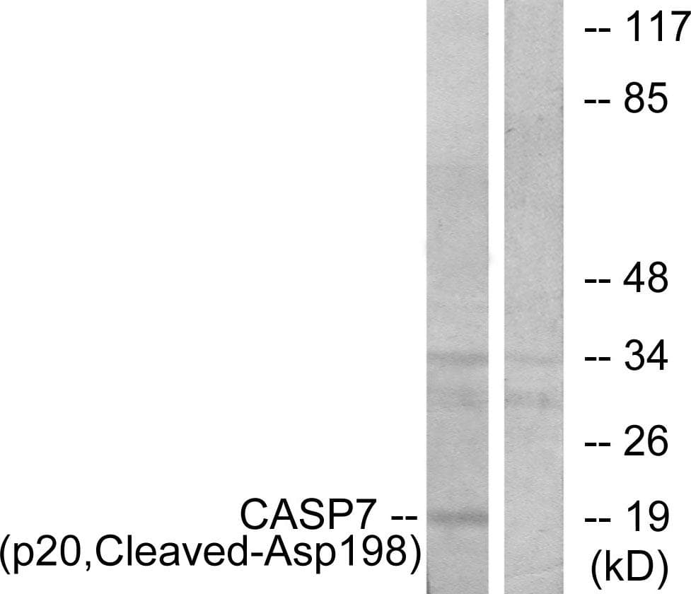 CASP7 / Caspase 7 Antibody (p20, Cleaved-Asp198)