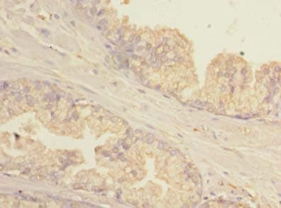 Polyclonal Rabbit anti-Human GBP5 Antibody (IHC, WB)