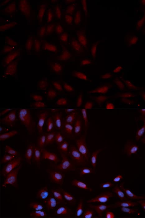 MAPK14 / p38 Antibody (phospho-Tyr322)
