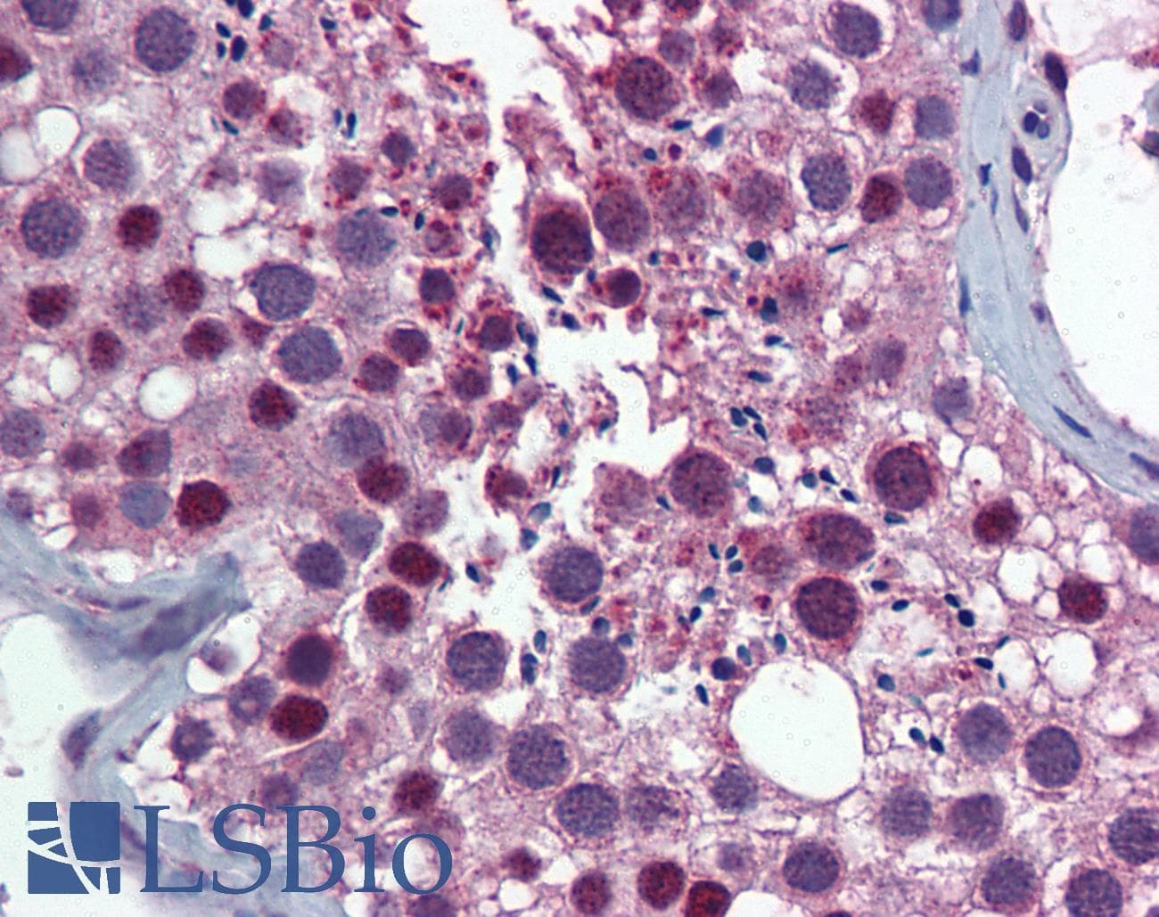 IHC-plus™ KPNA1 / Importin Alpha 5 Antibody (clone 2A4-1B5)