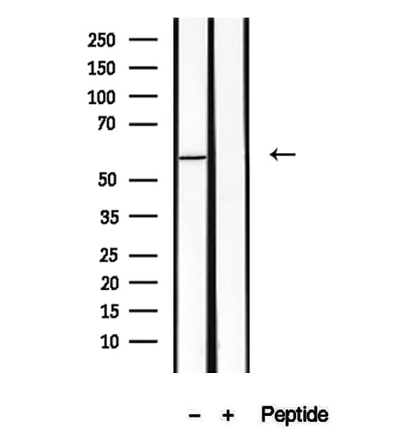 PKLR Antibody