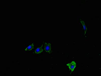 Polyclonal Rabbit anti-Mouse LYPLA1 Antibody