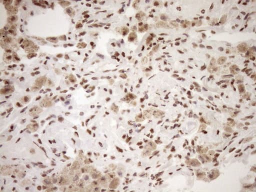 EXOSC1 / CSL4 Antibody (clone OTI1H9)