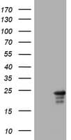 Monoclonal Mouse anti-Human VILIP / VSNL1 Antibody (clone OTI2F7, WB)