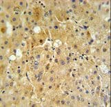 CYPOR / POR Antibody (aa462-488)