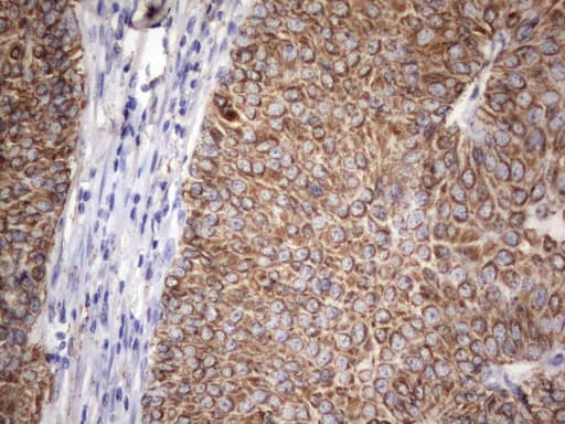 Acidic Cytokeratin Antibody (clone 7F10)