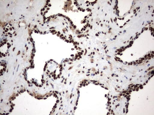 MLF1 Antibody (clone UMAB138, Carrier-free)