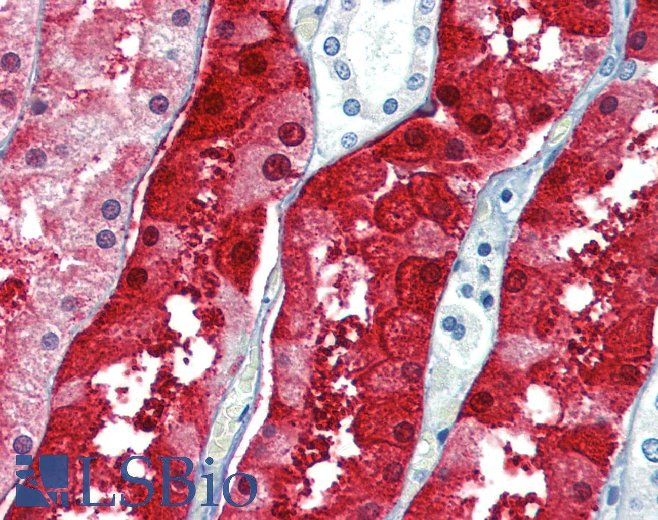 IHC-plus™ SPG15 / ZFYVE26 Antibody