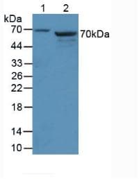 AMH / Anti-Mullerian Hormone Antibody (aa453-560)