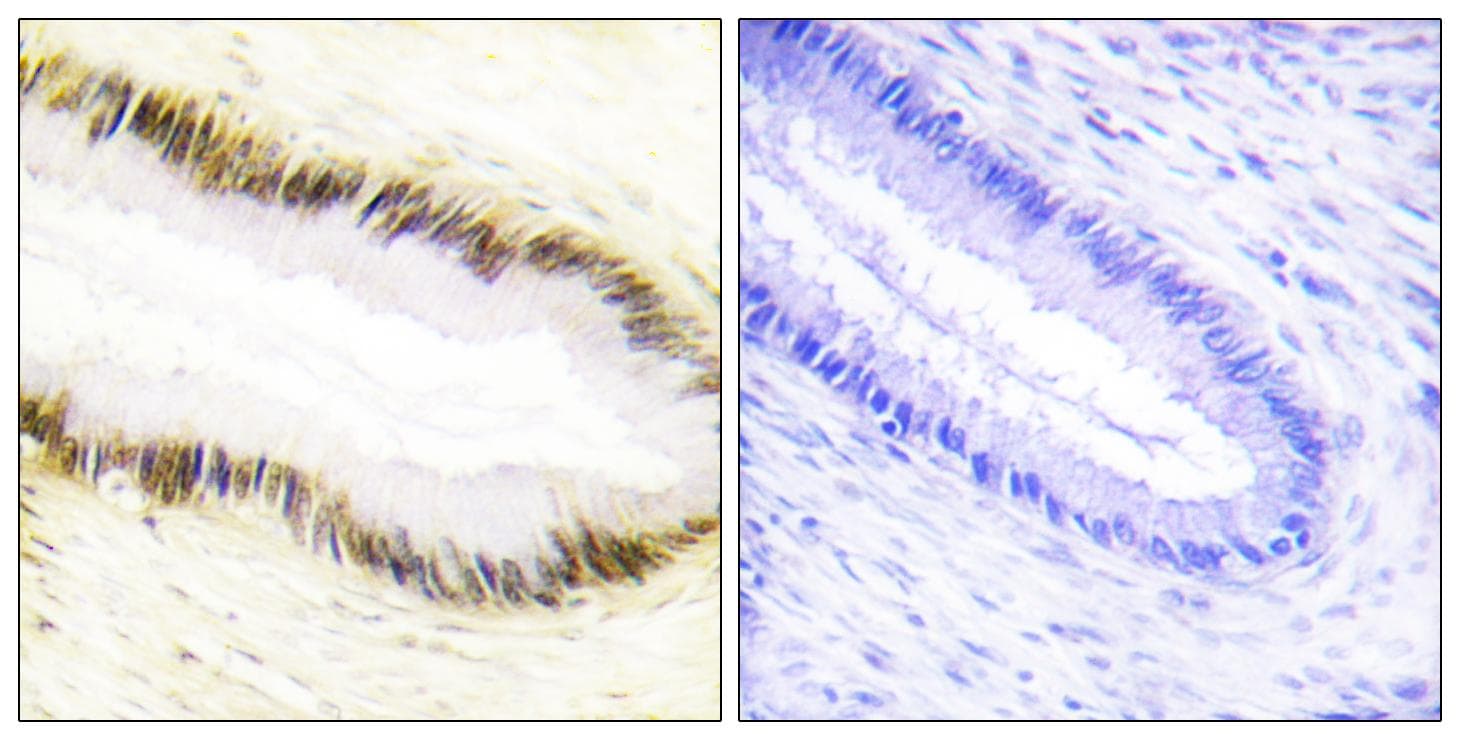 Polyclonal Rabbit anti-Human EAR2 / NR2F6 Antibody (IHC, IF, WB)
