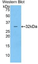 CTSV / Cathepsin V Antibody (aa64-334)