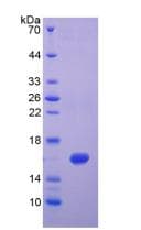 Human IFN Gamma / Interferon Gamma Protein (Recombinant His, N-Terminal)