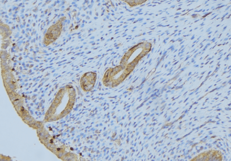 PPP2R1B Antibody