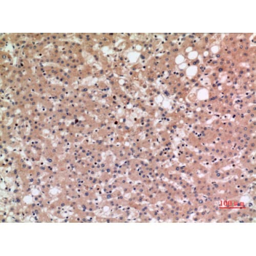 Polyclonal Rabbit anti-Human SLC10A1 / NTCP Antibody (281-330 aa, C-terminal, IHC, WB)