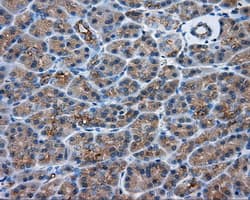 PRKAR2A Antibody (clone OTI4A3)