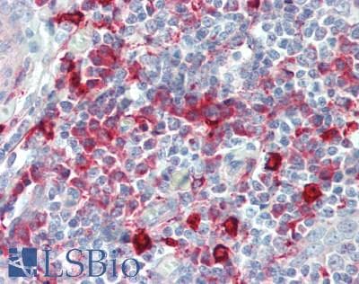 IHC-plus™ Polyclonal Rabbit anti-Human LGMN / Legumain Antibody (aa83-112, IHC, WB)