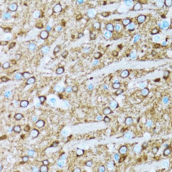 ENO2 / NSE Antibody