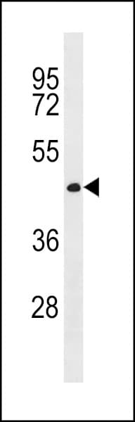 CWC27 Antibody (aa411-437)