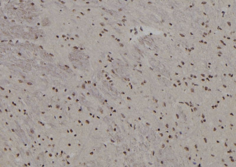 BACH2 Antibody
