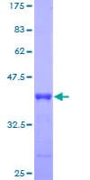 Human HBXIP Protein (Recombinant GST)