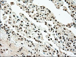 TYRO3 Antibody (clone OTI4C8)