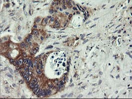 UBE2J1 Antibody (clone OTI3E6)