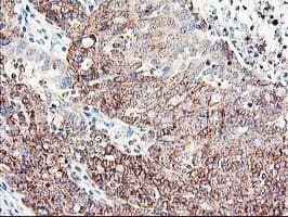 CNDP2 Antibody (clone OTI6D3)