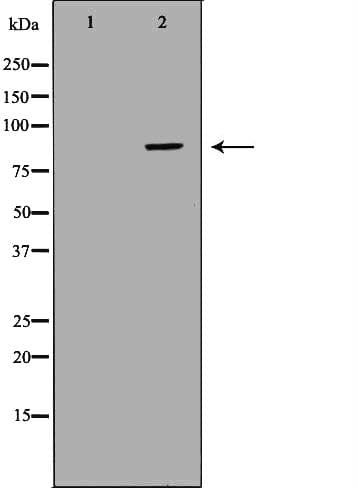 CFB / Complement Factor B Antibody
