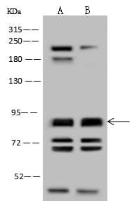 NPHP1 / Nephronophthisis Antibody