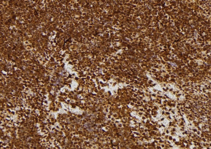 Polyclonal Rabbit anti-Human MECOM / EVI1 Antibody (IHC, WB)