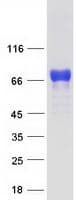 Human PML Protein (Recombinant Myc-DDK (Flag))