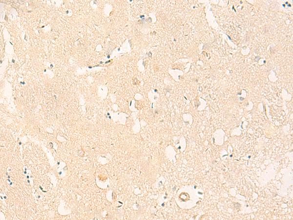IL37 Antibody