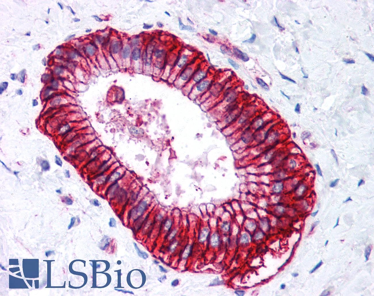 CA9 / Carbonic Anhydrase IX Antibody (C-Terminus, DY488)