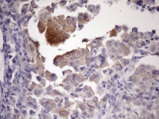 PDIA6 / ERP5 Antibody (clone OTI8H4)