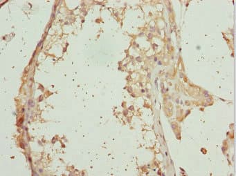 Polyclonal Rabbit anti-Human RAB31 Antibody (IHC)
