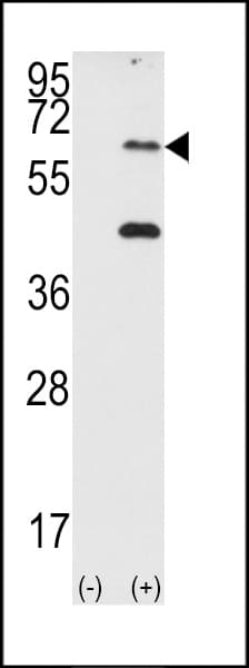 Polyclonal Rabbit anti-Human EIF2AK2 / PKR Antibody (aa11-42, IHC, WB)