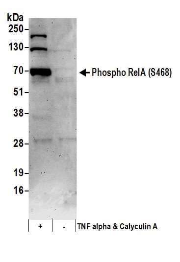 RELA / NFKB p65 Antibody (phospho-Ser468)