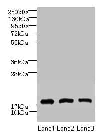 Polyclonal Rabbit anti-Human CNIH2 Antibody (IHC, WB)