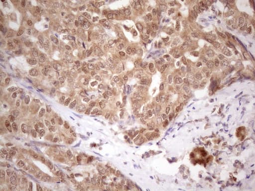 Monoclonal Mouse anti-Human PRPK / TP53RK Antibody (clone OTI5B2, Carrier-free, IHC, WB)