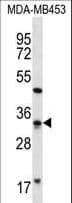 FTSJ1 Antibody (aa1-30)