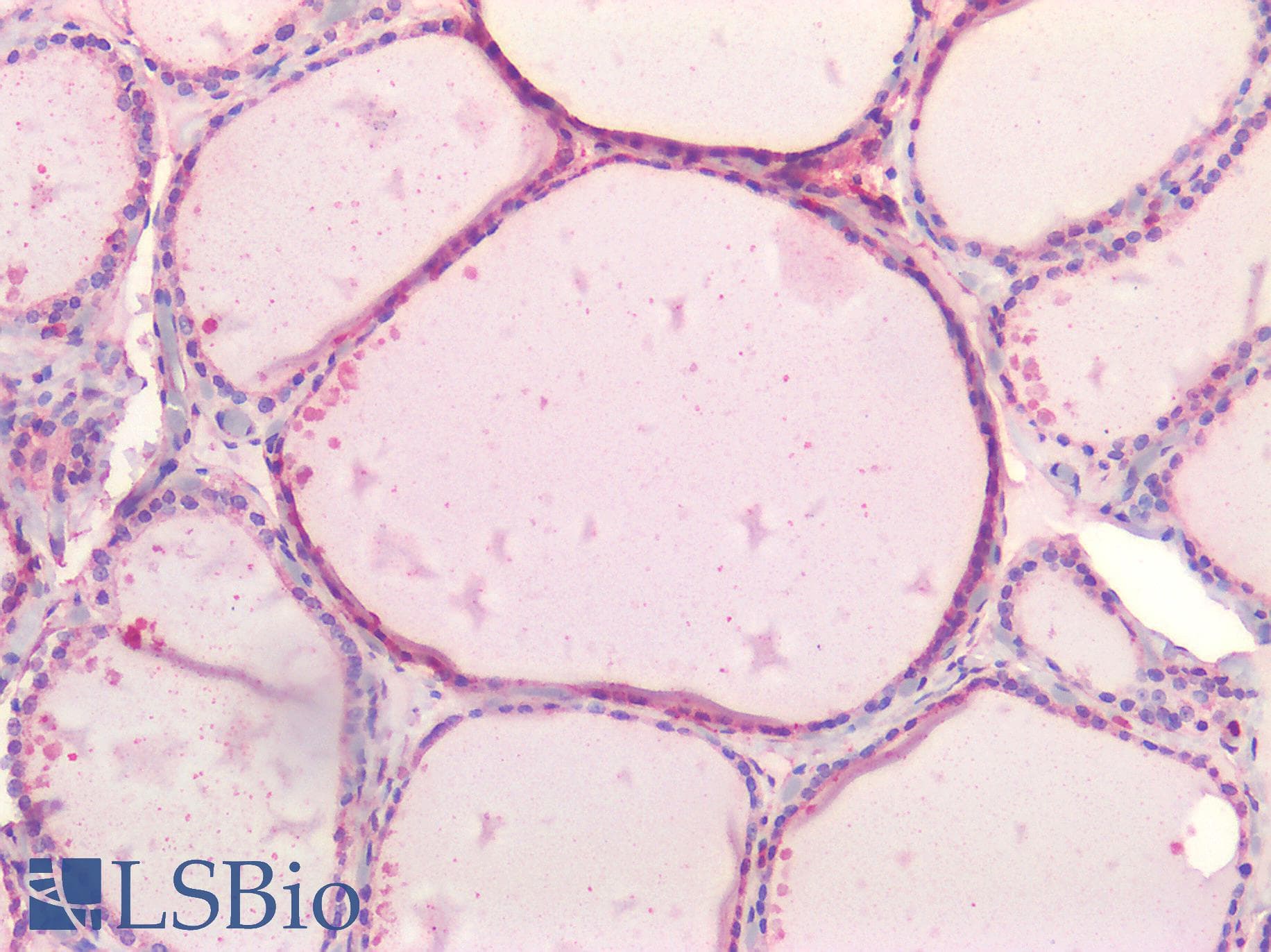 IHC-plus™ NOTCH2 Antibody