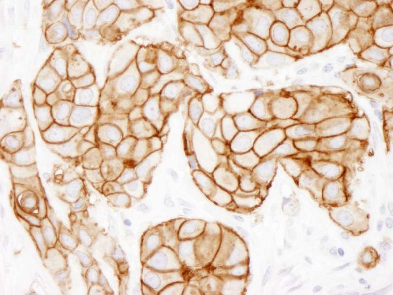 Polyclonal Rabbit anti-Human ERBB2 / HER2 Antibody (aa1200-C-term, IHC, IF)