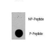 Polyclonal Rabbit anti-Human Tuberin / TSC2 Antibody (phospho-Ser1420, IF)