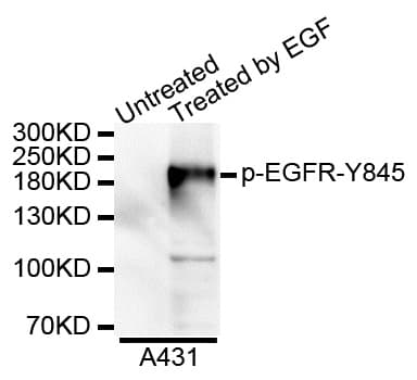 EGFR Antibody (phospho-Tyr869)