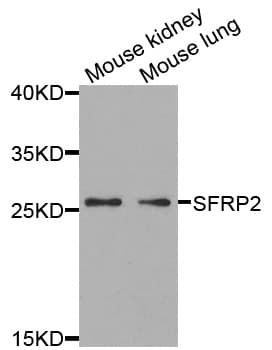 Polyclonal Rabbit anti-Human SFRP2 Antibody (IHC, IF, WB)