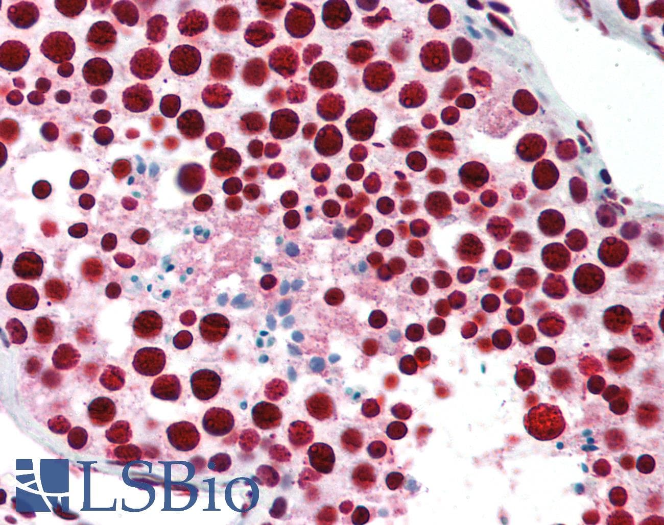 PathPlus™ NPM1 / NPM / Nucleophosmin Antibody