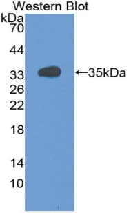 GDI1 Antibody (aa1-274)